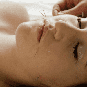 Cosmetic Acupuncture