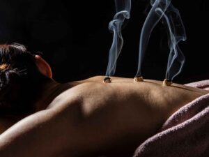 Moxibustion Kelowna