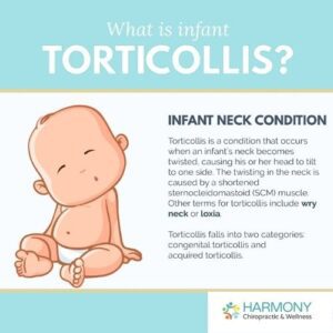 infant torticollis and chiropractic care kelowna
