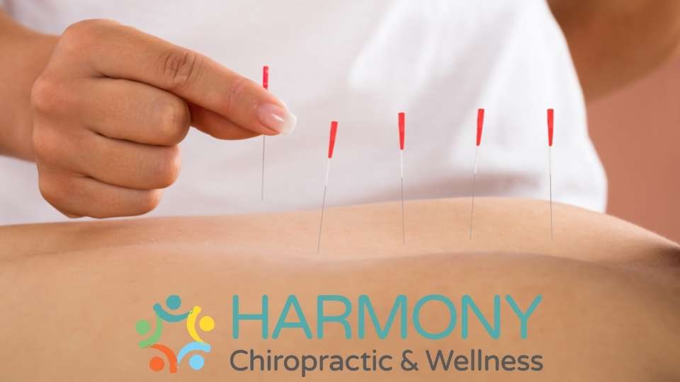 A person is holding onto acupuncture needles