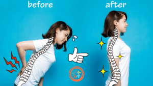Ways to fix bad posture with chiropractic