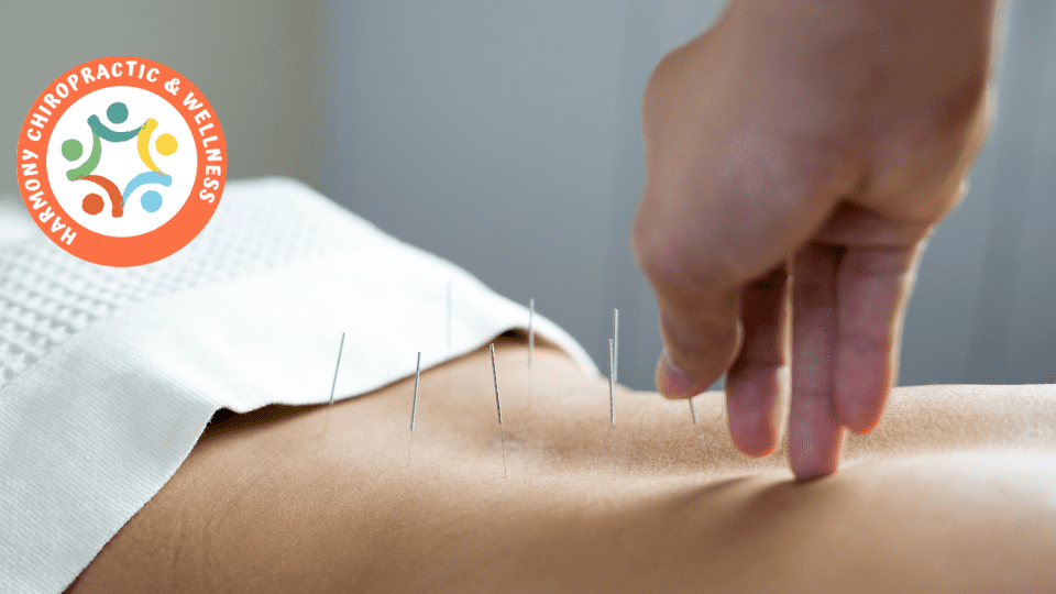 A person is getting ready to use acupuncture needles.