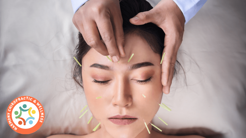 A woman getting acupuncture on her forehead